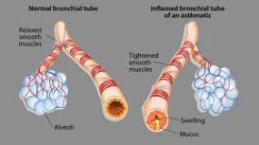 Stressed individual experiencing shortness of breath representing acute respiratory discomfort