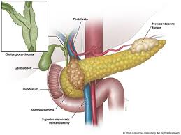Pancreatic